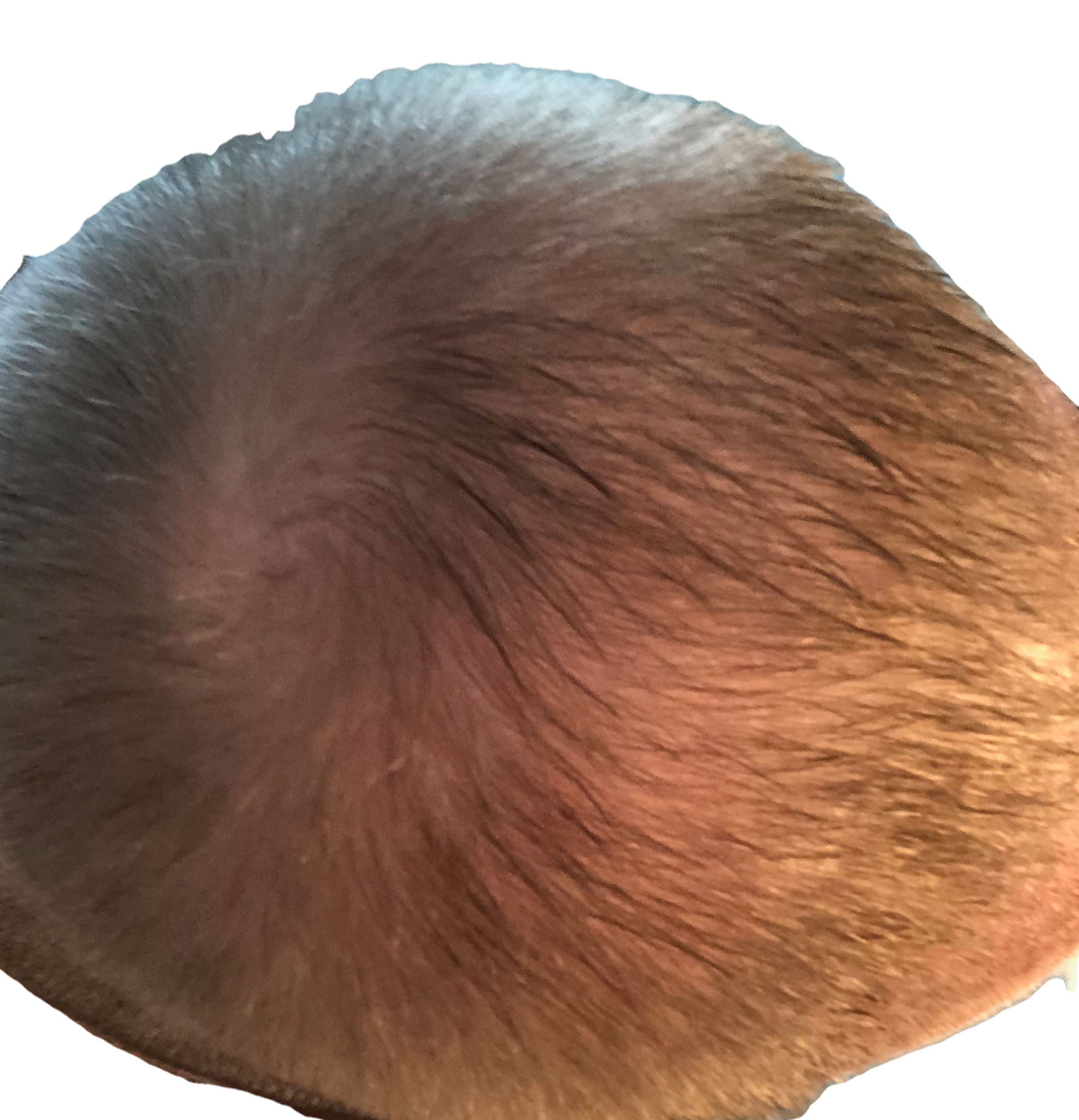 crown of head photo of me three days after a hair transplant