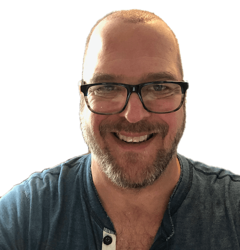 Front view after eight days from hair transplant