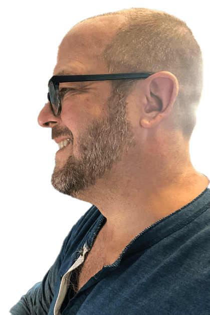 Left side of head after eight days from hair transplant